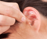 auriculotherapy-or-auricular-acupuncture